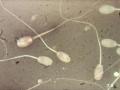 人間の睾丸で発見された“マイクロプラスチック” – 精子の質を低下させている可能性