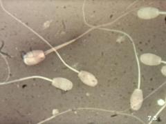 人間の睾丸で発見された“マイクロプラスチック” – 精子の質を低下させている可能性のイメージ画像