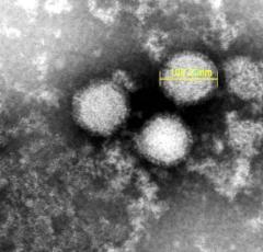 マダニ媒介のウイルス感染症「SFTS」 宮城で患者を初確認 90代男性が発症し入院中のイメージ画像