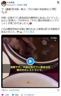 中国・骨スープから「チタン製の外科用インプラント」が見つかる。手術に使われる“人体用の釘”かのイメージ画像