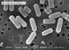 帝京長岡高校でウェルシュ菌による集団食中毒 50人に下痢や吐き気の症状…運動部員専用の食堂で提供された食事が原因 新潟・長岡市のイメージ画像