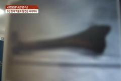 5年前に家出したという義母…浄化槽から「白骨」で発見される＝韓国のイメージ画像
