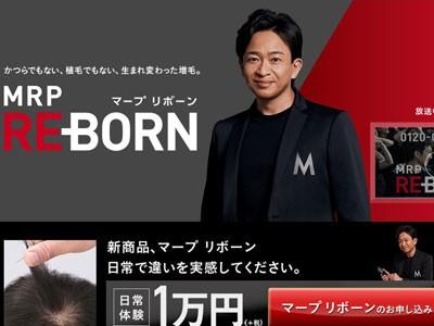 城島茂&quot;増毛CM出演&quot;で再燃!?最新ジャニーズ「ハゲ」事情！