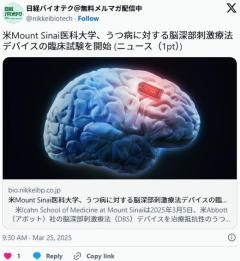 うつは甘え。頭に電気ショックで9割が改善、7割の患者は完治のイメージ画像
