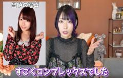 【〇〇がコンプレックス？】YouTuberえっちゃんが整形手術を語る