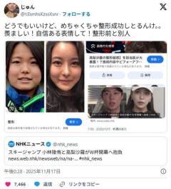 【画像あり】スキーの高梨沙羅選手顔が変わりすぎて誰だか分からなくなる・・のイメージ画像
