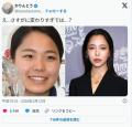 【画像】高梨沙羅さん、顔が変わったと指摘されてしまうww