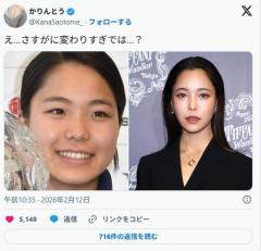 【画像】高梨沙羅さん、顔が変わったと指摘されてしまうwwのイメージ画像