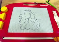 子どもに「ハート描いて」と頼まれた心臓外科医ガチすぎる“ハート”を描き上げるのイメージ画像