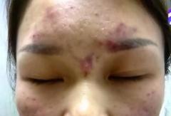中国の美容院が洗顔サービスをお薦め 12万円請求するボッタクリ詐欺だった
