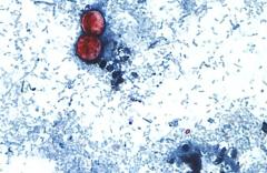 重い下痢引き起こす寄生虫由来の感染症、米ミシガン州で患者2600人超のイメージ画像
