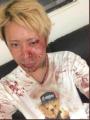 「会津の喧嘩屋」YouTuberが暴行被害 血まみれ姿を公開...「一方的にやられた」「法的手段とります」