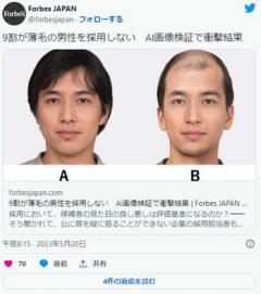 【彡⌒ミ】企業の9割、薄毛の男性を採用しないAI画像検証で衝撃結果