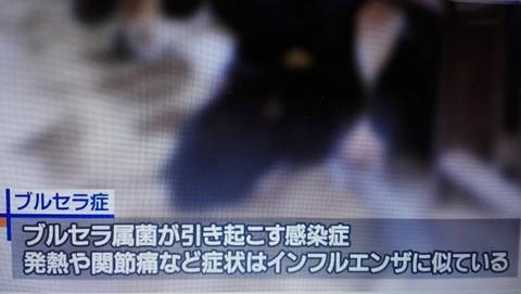 新種の「ブルセラ症」海外渡航歴のない64歳が発症 長野県