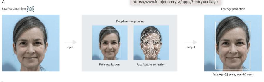 自撮り写真でがん生存率を予測可能？ AIツールFaceAgeが生物学的年齢を推定、正確性は臨床医を上回る