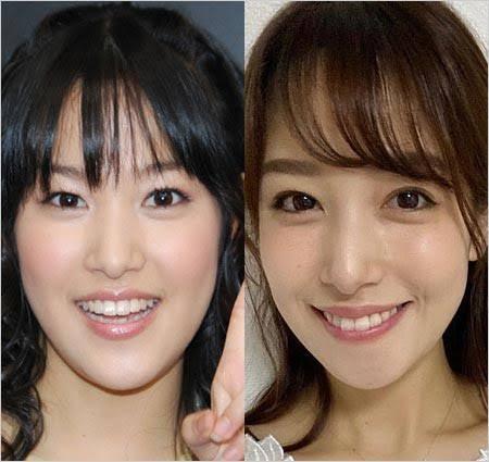 随分と顔変わったよね 鷲見玲奈 浴衣姿に一部から大ブーイング 自信あるんだろうな 爆サイ Com九州版