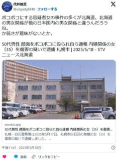 【北海道】50代男性 顔面をボコボコに殴られ自ら通報 内縁関係の無職女（35）を傷害の疑いで逮捕 札幌市のイメージ画像