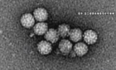 患者が急増…全県に「ノロウイルス食中毒注意報」 長野県のイメージ画像
