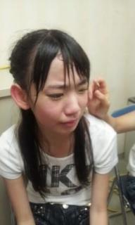 Hkt48 整形モンスター 宮脇咲良 涙袋の巨大化が話題 芸能ニュース掲示板 爆サイ Com関東版