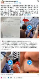 【動画】仁藤夢乃さん参政党の演説中に、三橋貴明に体当たりされ負傷のイメージ画像
