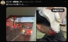 法政大ハンマー被害者がXに出現のイメージ画像