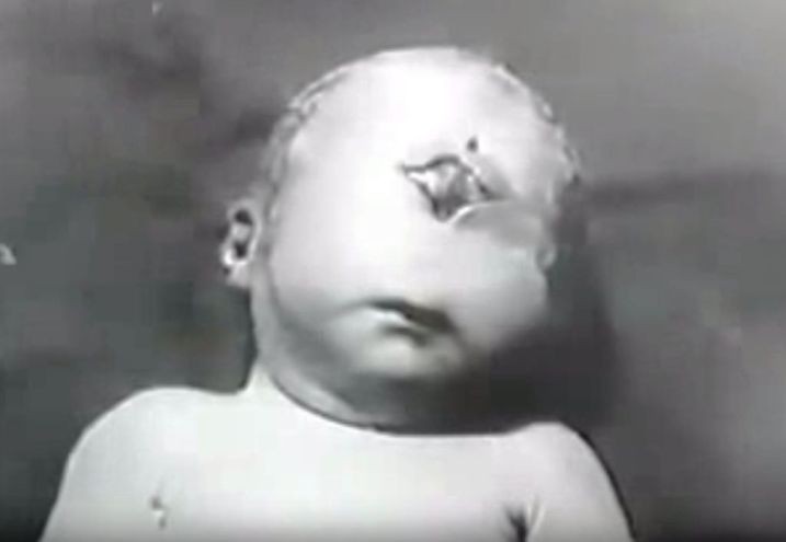 単眼症 現代アート作品の価値が上昇する流れを理解しておこう 爆サイ Comフィリピン版