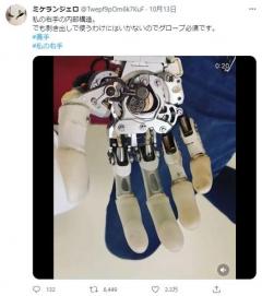 現代のオートメイル 義手ユーザーが内部構造を紹介