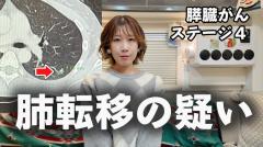 すい臓がん公表のサニージャーニー、肺転移の疑いがあることを報告のイメージ画像