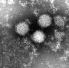 マダニ感染症｢SFTS｣ 80代女性が感染 病院で治療続く… 愛知県内での確認はことし初 冬も注意を 豊田市のイメージ画像