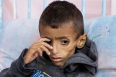イスラエルの封鎖によりガザ地区では57人が餓死、飢餓状態が続く