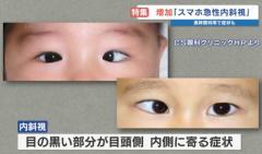 「スマホ急性内斜視」の子どもが急増 スマホの利用頻度が影響かのイメージ画像