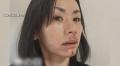 医師「傷跡が結構残る」元グラビアアイドル・小島可奈子さん（49）が犬に顔をかまれ30針を縫うけが「犬は悪気ない」