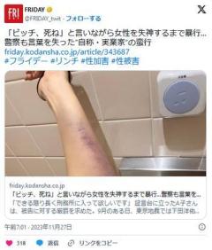【東京】『ここまで酷い暴行事件は聞いたことがない』「ビッチ死ね」と言いながら女性を失神するまで暴行…自称・実業家の蛮行のイメージ画像