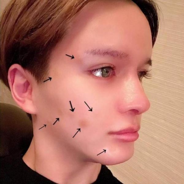 Matt、ホクロを除去報告にネット驚愕「すっぴんが美しすぎる」