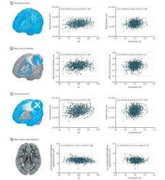 「歩くのが遅い人は脳が小さくIQが低い」──歩行速度と脳の構造に相関あり？ 米国チームの実験結果のイメージ画像