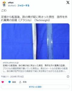 足場から転落した男性作業員鉄の棒が肛門を突き刺し、胸まで到達するも生還のイメージ画像