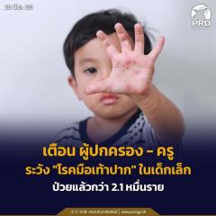 タイ全国で手足口病拡大中、乳幼児に2万件超の感染確認