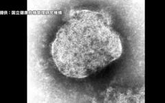 はしか感染「予防接種2回でも」 鹿児島の40代男性で確認、抗体検査を呼びかけのイメージ画像