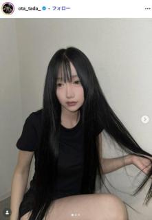 「月曜から夜ふかし」多田さん、インディバのビフォーアフター公開「一目瞭然」「変化がすごい」と話題のイメージ画像
