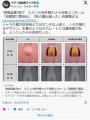 【画像】ミズノが陸上女子用の赤外線..