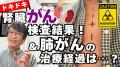 ITジャーナリストの三上洋、胃がん手..