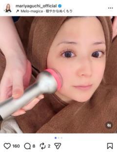 「整形してますか？」への回答は…矢口真里が明かした美容医療のリアル！“一気に5種”の激変ぶりに驚愕