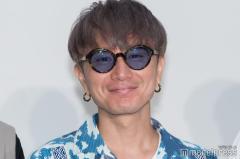 SUPER EIGHT安田章大、髄膜腫の手術後生活に変化 後遺症と向き合う日々とは「光の刺激をなるだけ少なくして」のイメージ画像
