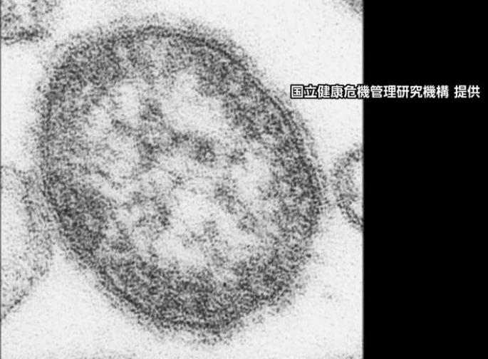 はしかワクチン無償接種を東京都きょう開始 はしか患者と接触した人を対象に 72時間以内なら発症予防効果