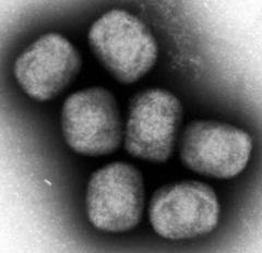 トンブリー刑務所の受刑者がエムポックスで死亡のイメージ画像