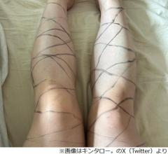 「網タイツがない、そうだ！」キンタロー。が閃いた結果…SNSで“注意喚起”