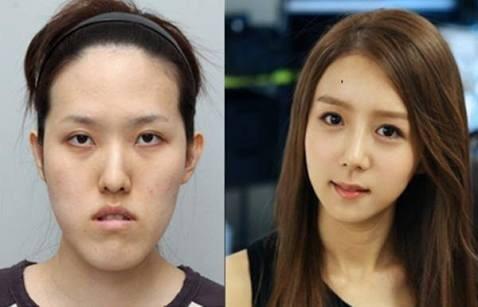 元々整形してるのに更u2026韓国アイドルがインスタに投稿も背景が歪み加工 