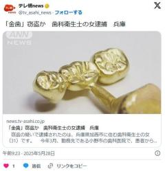 「金歯」窃盗か歯科衛生士の女逮捕兵庫のイメージ画像