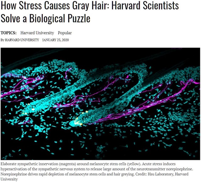 ストレスで白髪が増えるメカニズムとは？ 興奮すると色素産生能力が奪われるの画像1