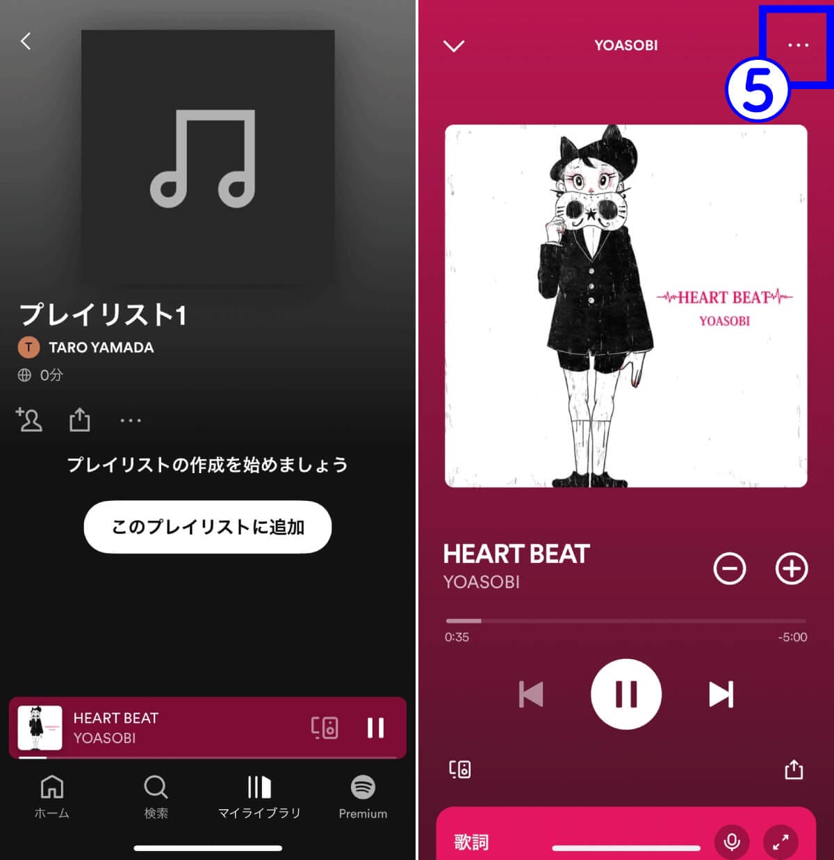 Spotifyの仕様は「意味が分からない」？再生中に違う曲が流れるなど諸問題への対処法の画像5